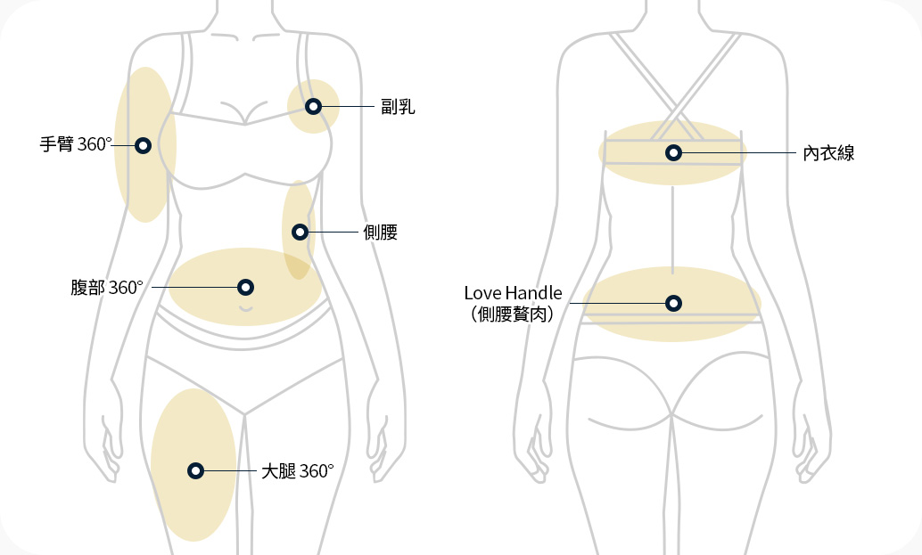지방흡입 부위 팔 360도 부유방 옆구리 복부 360도 허벅지 360도 브라라인 러브핸들