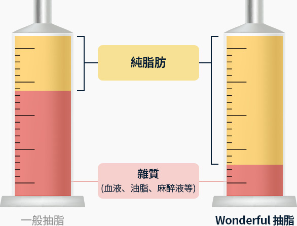원더풀 바디 지방흡입 불순물 혈액 오일 마취용액 등 보다 높은 비율의 순수지방 추출