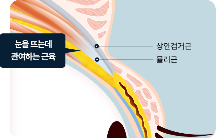 상안검거근 뮬러근
