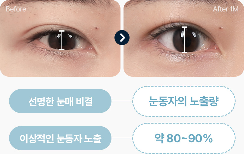 선명한 눈매 눈동자 노출량 80% 90% 