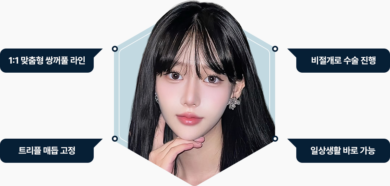 자연유착 맞춤라인 비절개 트리플매듭 일상생활 바로 가능