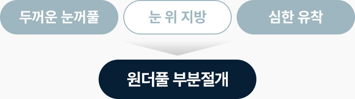 부분절개 완전절개효과 두꺼운눈꺼풀 눈위지방 심한 유착