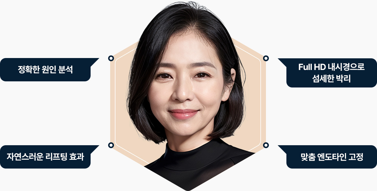 이마거상 정확한 원인분석 full HD 내시경으로 섬세한 박리 자연스러운 리프팅 효과 맞춤 엔도타인 고정