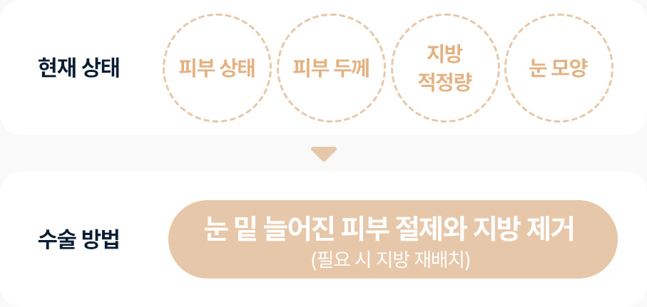 하안검 증상 피부상태 피부두께 지방적정량 눈모양 상태 확인 눈 밑 늘어진 피부절제 지방제거 필요시 지방재배치