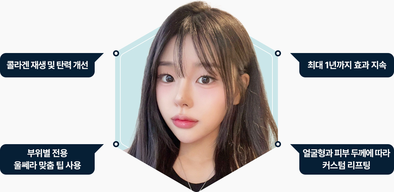 울쎄라 콜라겐 재생 탄력개선 최대1년 효과지속 부위별 전용 맞춤 팁사용 얼굴형 피부두께에 따라 커스텀리프팅
